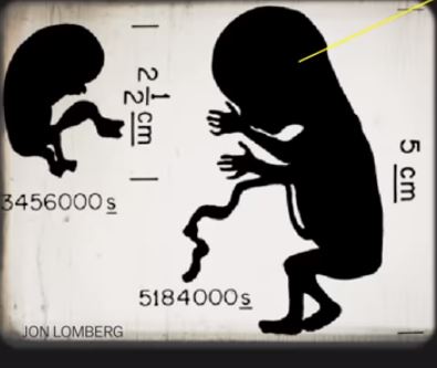 Fetus diagram 30