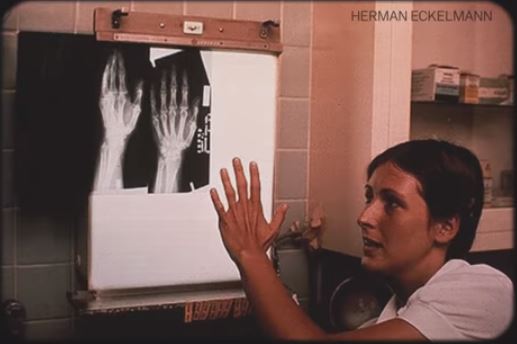 X-ray of hand 99